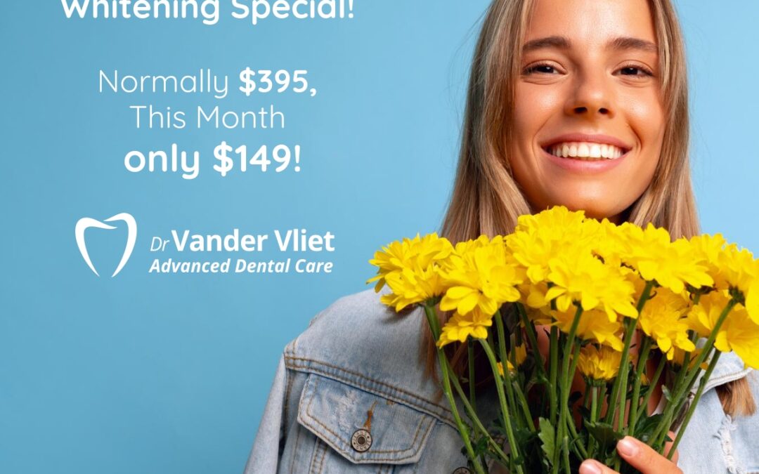 It’s the May Home Whitening Special