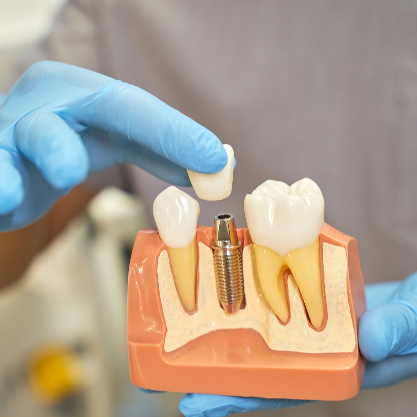 Digital Dental Consultation, Hackettstown NJ