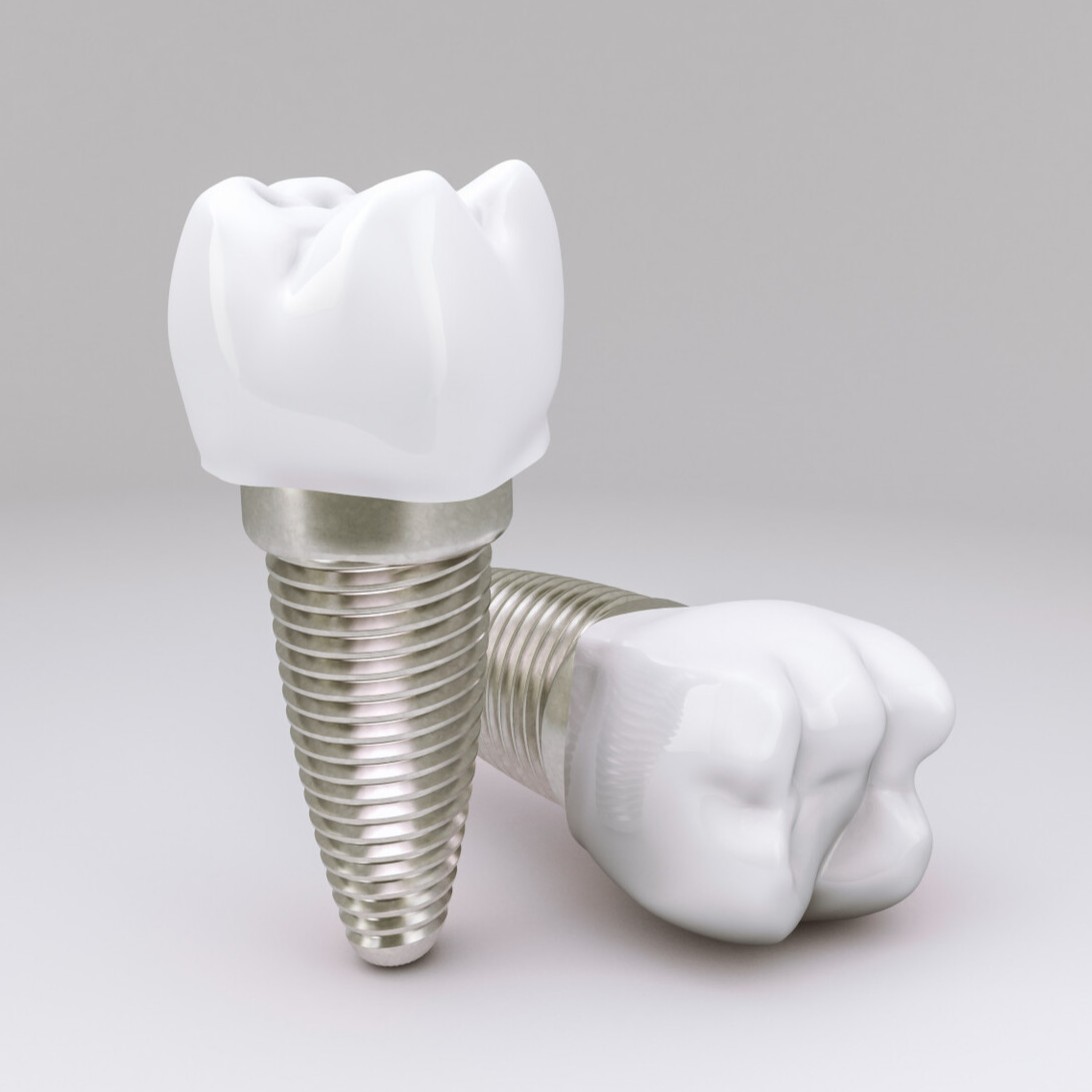 Senior Dental Care and Implants