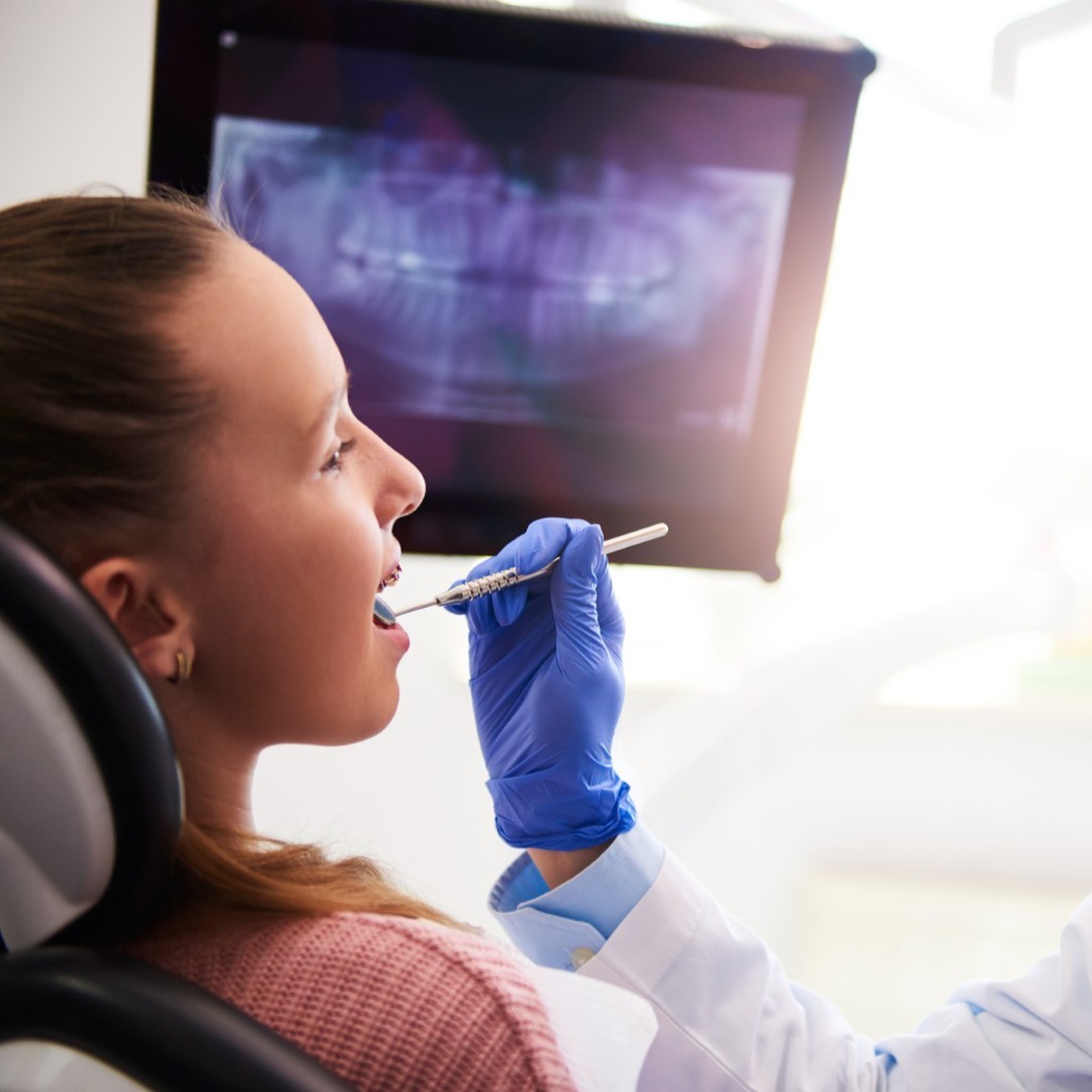 Panoramic dental x-ray image showing full mouth structure