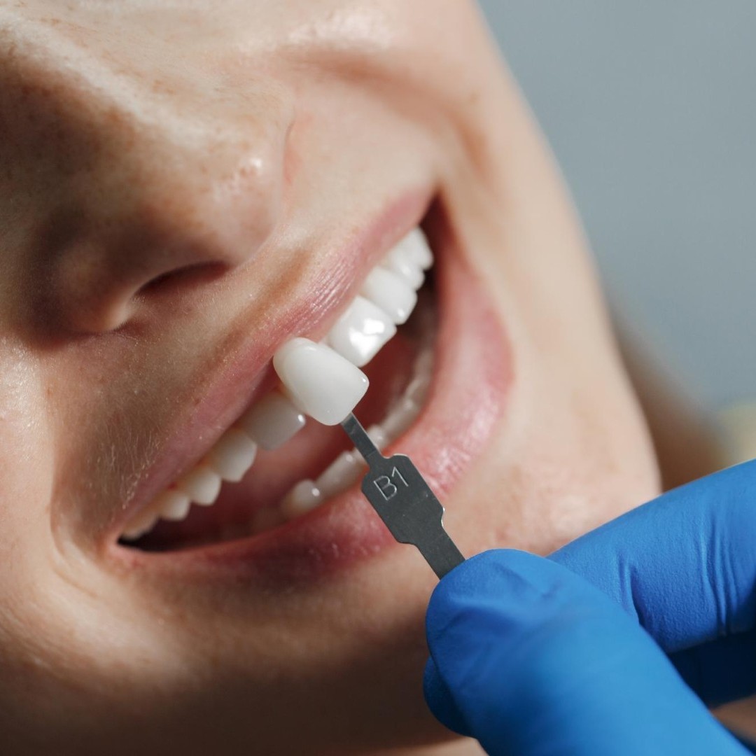 Fixed Prosthetics in Hackettstown, NJ