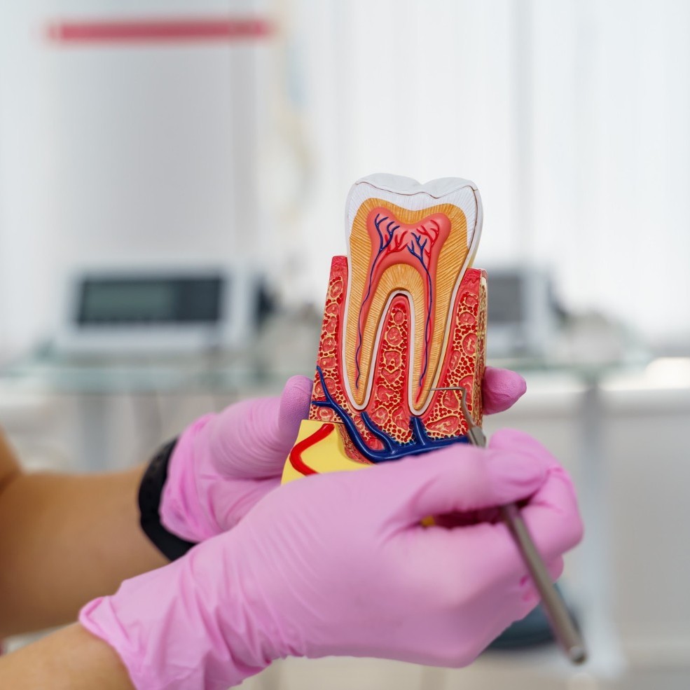 Root Canals - Presentation - Hackettstown Causes of Tooth Pain Hackettstown NJ