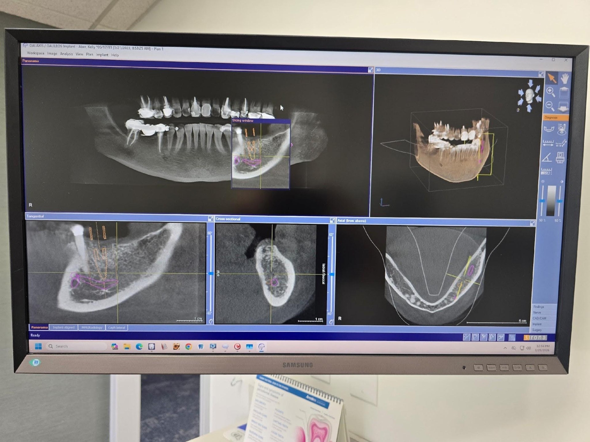 CBCT results