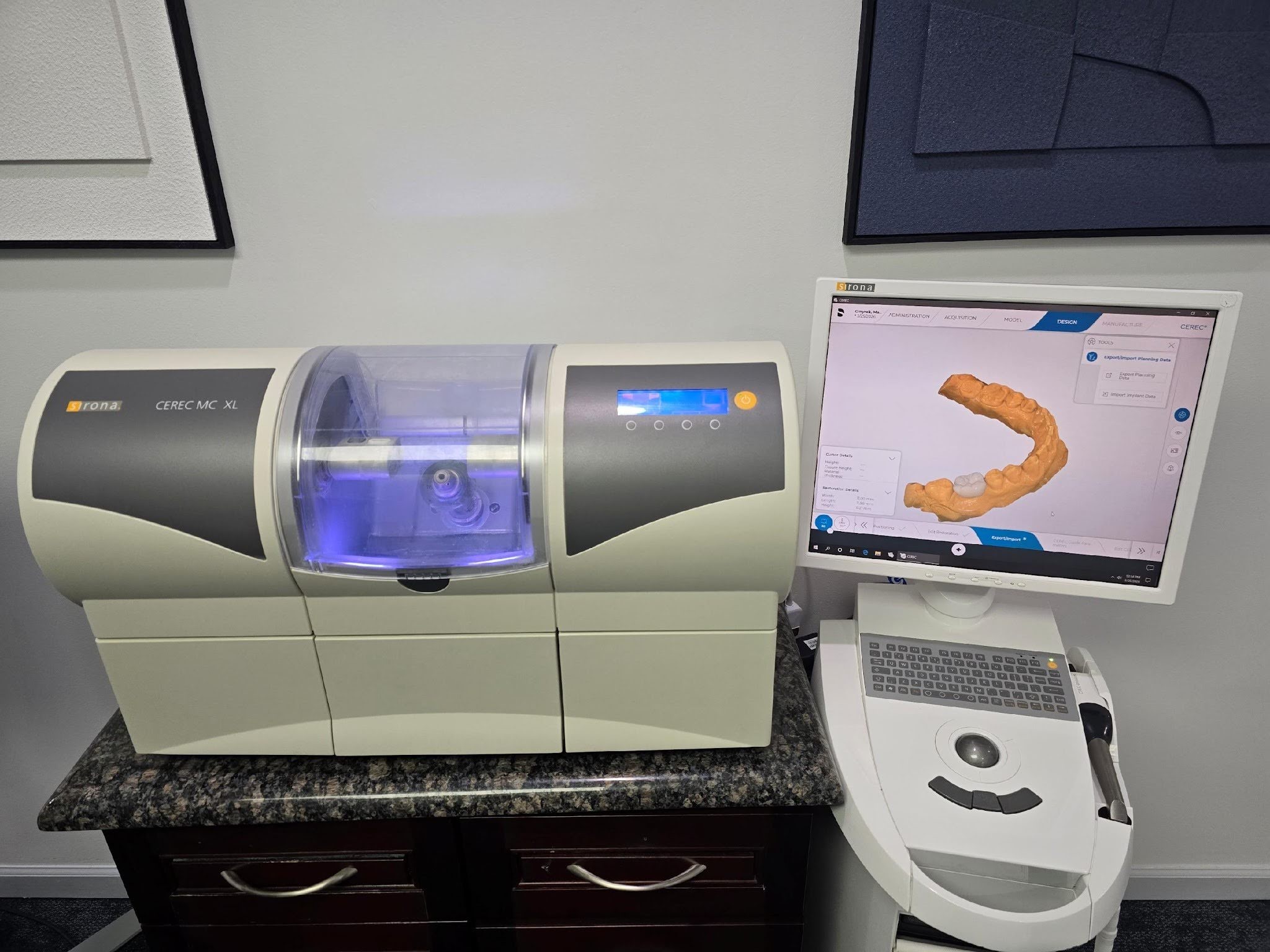 What is CEREC What is CEREC